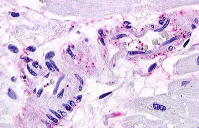 Immunohistochemistry (Formalin/PFA-fixed paraffin-embedded sections) - Anti-S1P1/EDG1 antibody (AB140952)