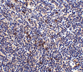 Immunohistochemistry (Formalin/PFA-fixed paraffin-embedded sections) - Anti-S1P1/EDG1 antibody (AB77076), expandable thumbnail
