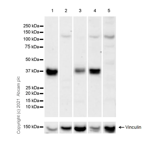 Western blot - Anti-S1P1/EDG1 antibody [EPR23535-103] (AB283502)