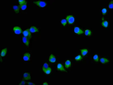 Immunocytochemistry/ Immunofluorescence - Anti-S1PR2 antibody (AB235919)