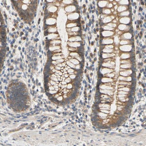 Immunohistochemistry (Formalin/PFA-fixed paraffin-embedded sections) - Anti-S2P antibody (AB244279)