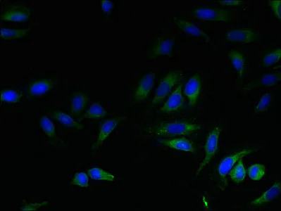 Immunocytochemistry/ Immunofluorescence - Anti-S31 antibody (AB236651)
