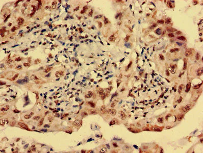 Immunohistochemistry (Formalin/PFA-fixed paraffin-embedded sections) - Anti-S31 antibody (AB236651)