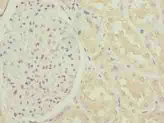Immunohistochemistry (Formalin/PFA-fixed paraffin-embedded sections) - Anti-S31 antibody (AB236651)