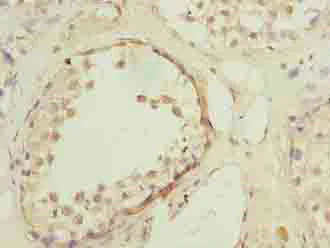 Immunohistochemistry (Formalin/PFA-fixed paraffin-embedded sections) - Anti-S31 antibody (AB236651)