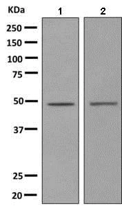 Western blot - Anti-S31 antibody [EPR10789(B)] (AB154813)