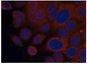 Immunocytochemistry/ Immunofluorescence - Anti-S6K1 antibody (AB131440)