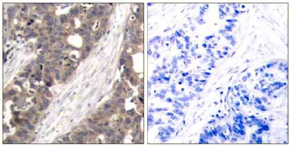 Immunohistochemistry (Formalin/PFA-fixed paraffin-embedded sections) - Anti-S6K1 antibody (AB131440)