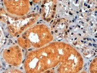 Immunohistochemistry (Formalin/PFA-fixed paraffin-embedded sections) - Anti-S6K1 antibody (AB14708)