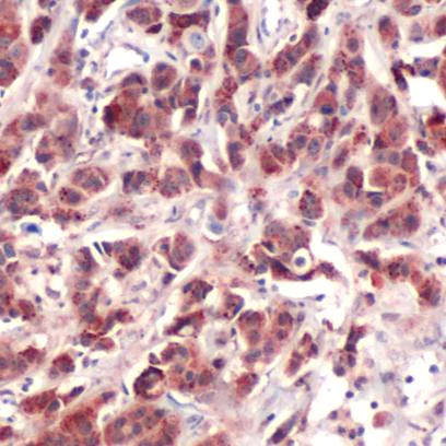 Immunohistochemistry (Formalin/PFA-fixed paraffin-embedded sections) - Anti-S6K1 antibody (AB227772)