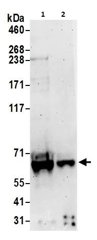 Western blot - Anti-S6K1 antibody (AB264128)