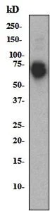 Western blot - Anti-S6K1 antibody [E175] (AB32359)