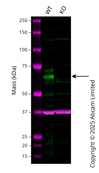 Western blot - Anti-S6K1 antibody [E175] (AB32359)