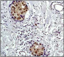 Immunohistochemistry (Formalin/PFA-fixed paraffin-embedded sections) - Anti-S6K1 antibody [E175] - BSA and Azide free (AB239810)