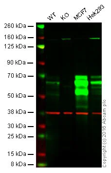 Western blot - Anti-S6K1 antibody [E175] - BSA and Azide free (AB239810)