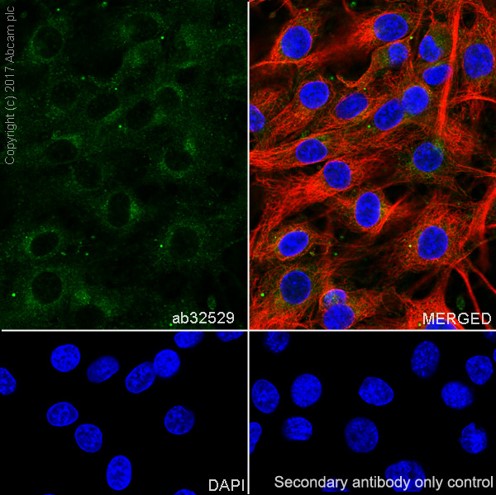 Immunocytochemistry/ Immunofluorescence - Anti-S6K1 antibody [E343] (ab32529), expandable thumbnail