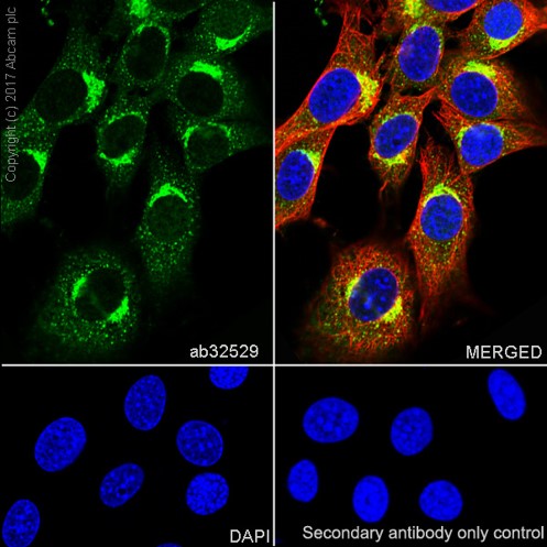 Immunocytochemistry/ Immunofluorescence - Anti-S6K1 antibody [E343] (ab32529), expandable thumbnail
