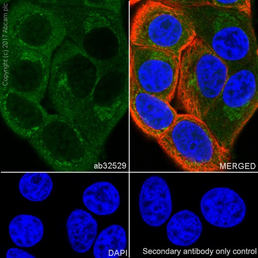Immunocytochemistry/ Immunofluorescence - Anti-S6K1 antibody [E343] (ab32529), expandable thumbnail