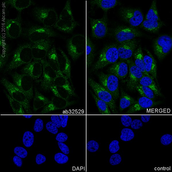 Immunocytochemistry/ Immunofluorescence - Anti-S6K1 antibody [E343] (ab32529), expandable thumbnail