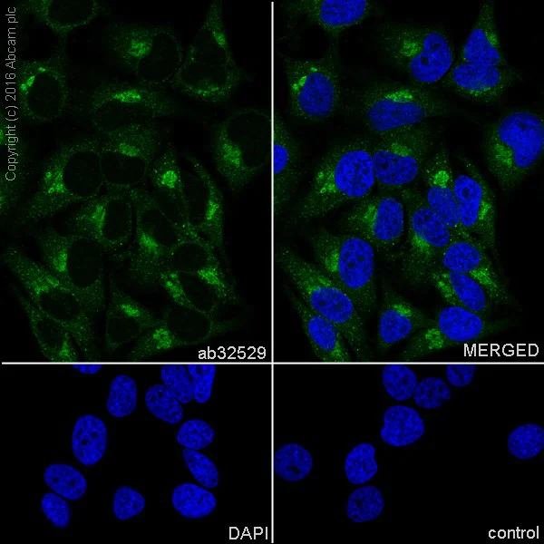 Immunocytochemistry/ Immunofluorescence - Anti-S6K1 antibody [E343] (AB32529)