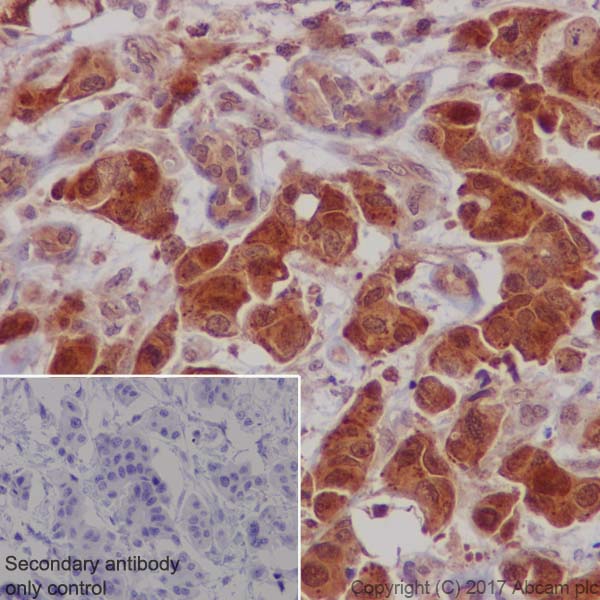 Immunohistochemistry (Formalin/PFA-fixed paraffin-embedded sections) - Anti-S6K1 antibody [E343] (AB32529), expandable thumbnail