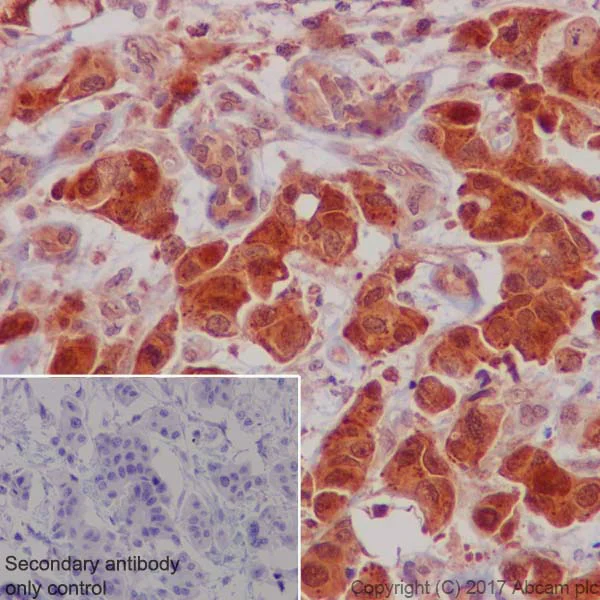 Immunohistochemistry (Formalin/PFA-fixed paraffin-embedded sections) - Anti-S6K1 antibody [E343] (AB32529)