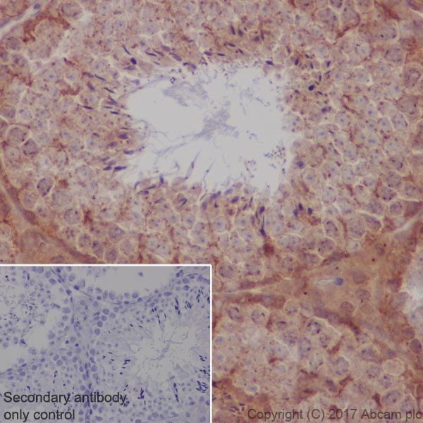 Immunohistochemistry (Formalin/PFA-fixed paraffin-embedded sections) - Anti-S6K1 antibody [E343] (AB32529), expandable thumbnail