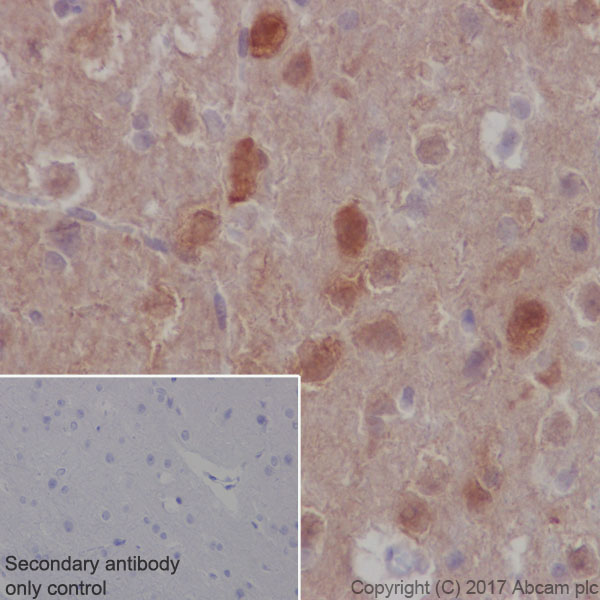 Immunohistochemistry (Formalin/PFA-fixed paraffin-embedded sections) - Anti-S6K1 antibody [E343] (AB32529), expandable thumbnail