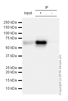 Immunoprecipitation - Anti-S6K1 antibody [E343] (ab32529), expandable thumbnail