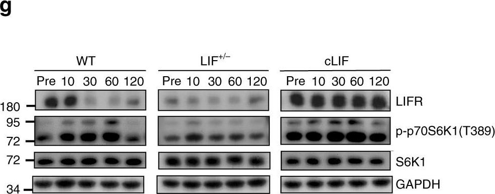 Western blot - Anti-S6K1 antibody [E343] (ab32529), expandable thumbnail