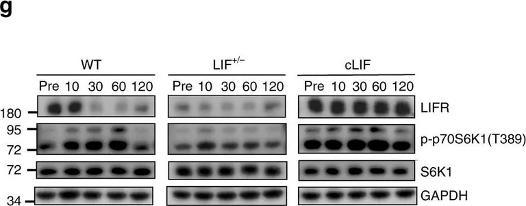 Western blot - Anti-S6K1 antibody [E343] (AB32529)