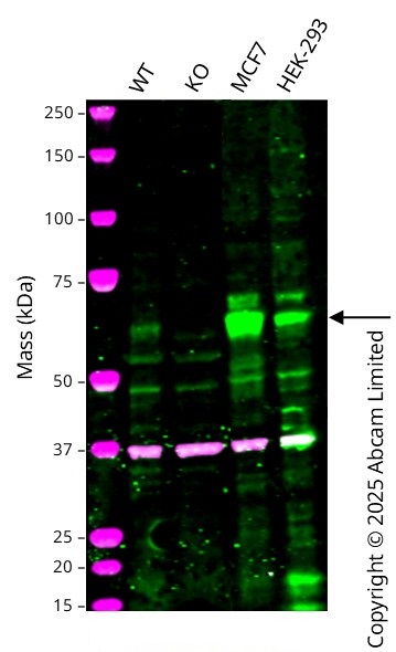 Western blot - Anti-S6K1 antibody [E343] (ab32529), expandable thumbnail