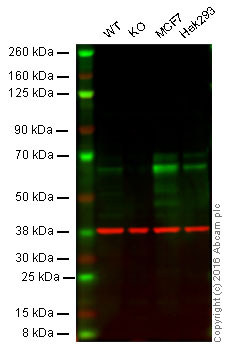 Western blot - Anti-S6K1 antibody [E343] (AB32529), expandable thumbnail