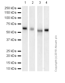 Western blot - Anti-S6K1 antibody [E343] (AB32529)