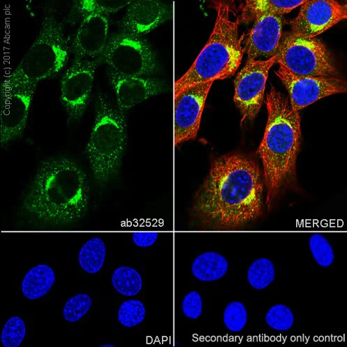 Immunocytochemistry/ Immunofluorescence - Anti-S6K1 antibody [E343] - BSA and Azide free (AB203558)