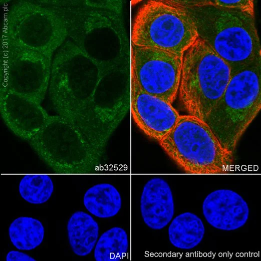 Immunocytochemistry/ Immunofluorescence - Anti-S6K1 antibody [E343] - BSA and Azide free (AB203558)