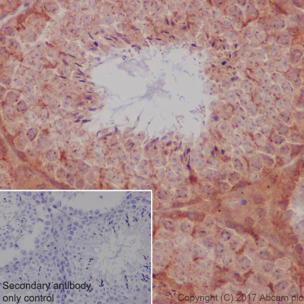 Immunohistochemistry (Formalin/PFA-fixed paraffin-embedded sections) - Anti-S6K1 antibody [E343] - BSA and Azide free (AB203558)