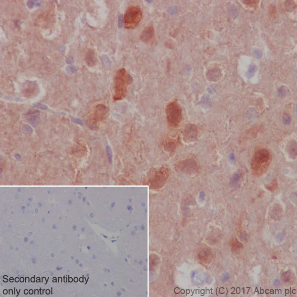 Immunohistochemistry (Formalin/PFA-fixed paraffin-embedded sections) - Anti-S6K1 antibody [E343] - BSA and Azide free (AB203558)