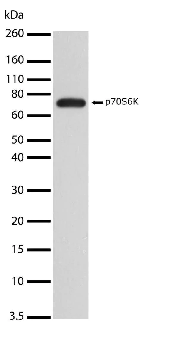 Western blot - Anti-S6K1 antibody [RP23040066] (AB308113)