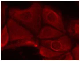 Immunocytochemistry/ Immunofluorescence - Anti-S6K1 (phospho S411) antibody (AB131459)