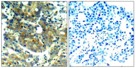 Immunohistochemistry (Formalin/PFA-fixed paraffin-embedded sections) - Anti-S6K1 (phospho S411) antibody (AB131459)