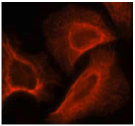 Immunocytochemistry/ Immunofluorescence - Anti-S6K1 (phospho S424) antibody (AB131436)