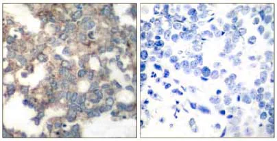 Immunohistochemistry (Formalin/PFA-fixed paraffin-embedded sections) - Anti-S6K1 (phospho S424) antibody (AB131436)