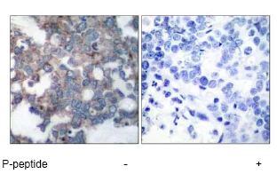 Immunohistochemistry (Formalin/PFA-fixed paraffin-embedded sections) - Anti-S6K1 (phospho S424) antibody (AB47379)