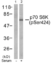 Western blot - Anti-S6K1 (phospho S424) antibody (AB47379)