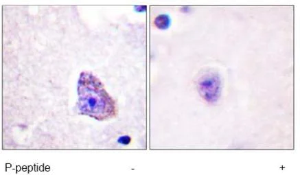 Immunohistochemistry (Formalin/PFA-fixed paraffin-embedded sections) - Anti-S6K1 (phospho T229) antibody (AB59208)