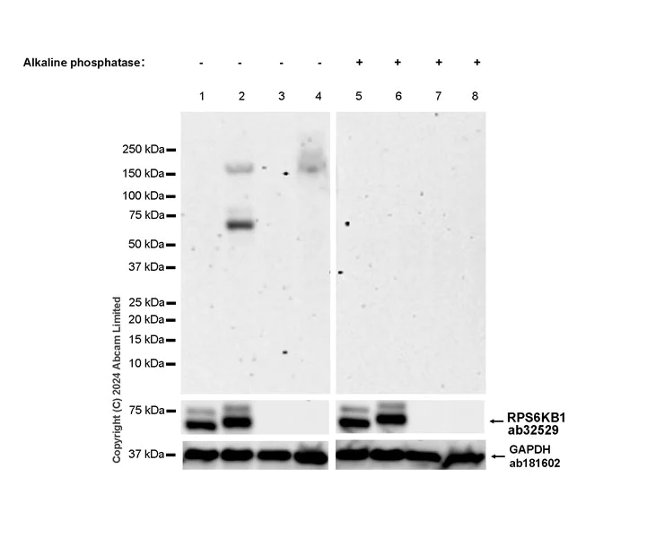 Western blot - Anti-S6K1 (phospho T389) antibody [EPR24766-9] (AB323272)
