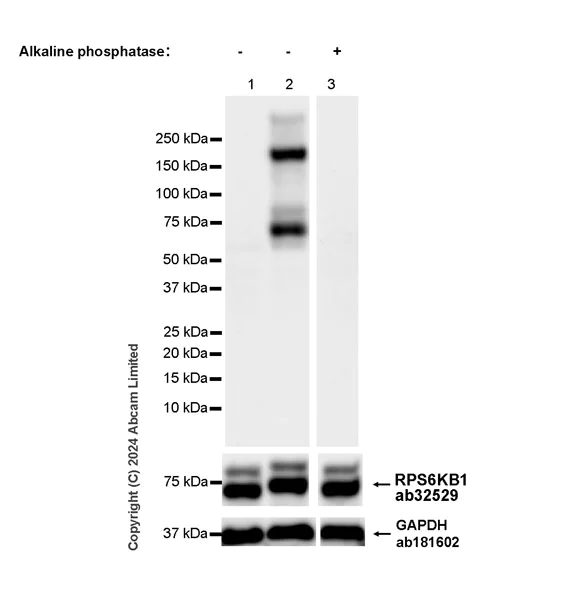 Western blot - Anti-S6K1 (phospho T389) antibody [EPR24766-9] (AB323272)