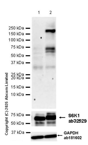 Western blot - Anti-S6K1 (phospho T389) antibody [EPR24766-9] (AB323272)