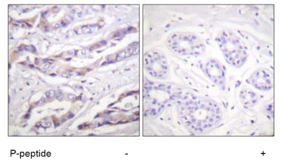 Immunohistochemistry (Formalin/PFA-fixed paraffin-embedded sections) - Anti-S6K1 (phospho T389 + T412) antibody (AB60948)